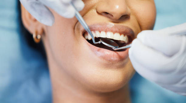 Best Emergency Wisdom Tooth Extraction in Sconsin Dells, WI