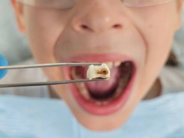Best Emergency Treatment for Jaw Pain or Injury in Sconsin Dells, WI